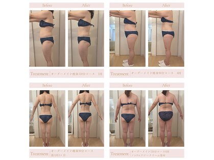 エミル(Emillu)の写真