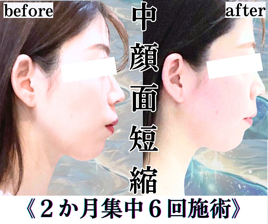 仙台市青葉区で小顔矯正・造顔がおすすめのサロン｜ホットペッパー