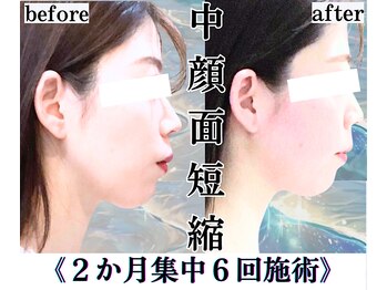 ボナボナ 仙台立町(BONA BONA)