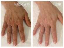 キレイテ 上野店/50代/1回目【ハンドケア稲荷町】