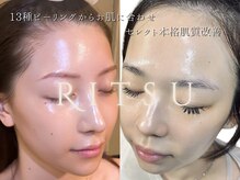 リツ 本店(Ritsu)