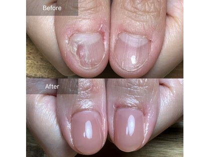 レイ(Rei)の写真