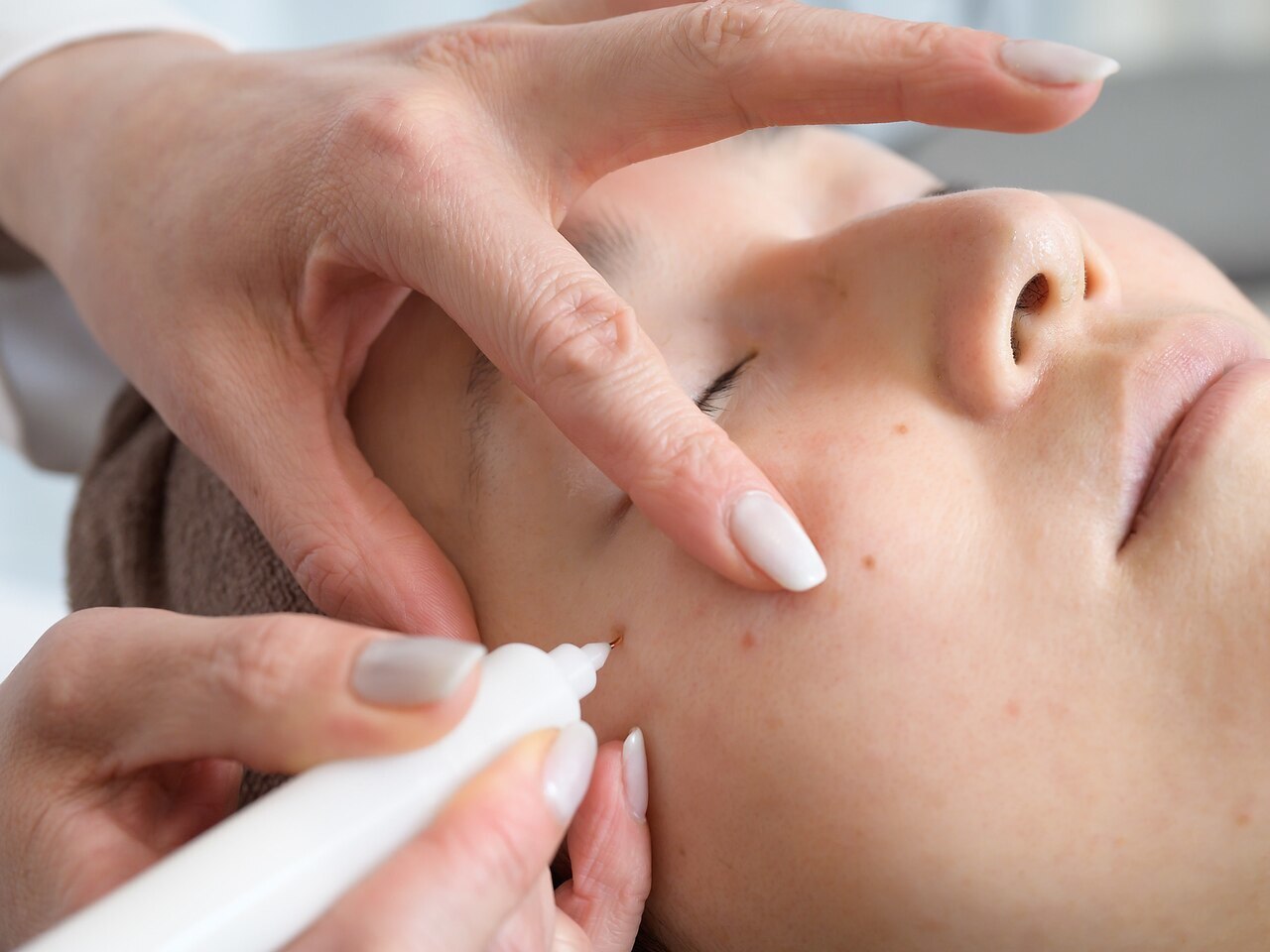 【初回限定】全顔20分シミ当て放題+美白フェイシャル70分\15000→\6500