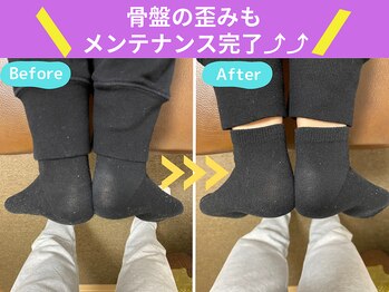 京都中丸整体カイロプラクティック/脚の長さ