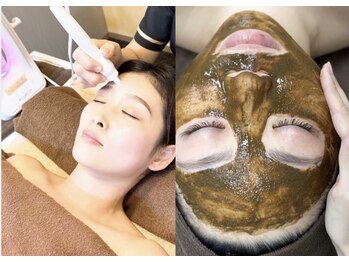 チャルム(CAL'ME)/ハーブピーリング+ハイドロ