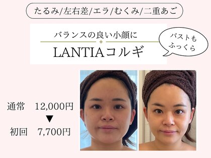 ランティア(LANTIA)の写真