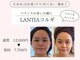 ランティア(LANTIA)の写真