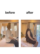 フィデル(fidele)/ストレートネック、猫背、肩痛