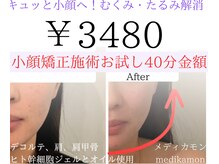 メディカモン(medikamon)