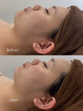 アンフィア(Anfia)/