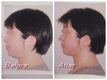 ドクター ヴィーナス/二重顎がスッキリ！