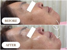 凜の雰囲気（［美肌シェービング］透明感・ツヤ・肌のなめらかさUP◎）