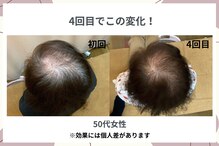 福山発毛センター