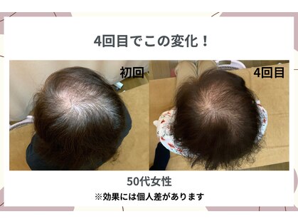 福山発毛センターの写真