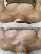 ワイサロン(Y salon)/40代/バスト/9カ月/C→Eカップ