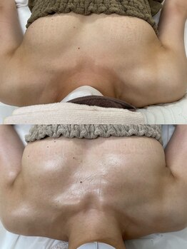 ワイサロン(Y salon)/40代/バスト/9カ月/C→Eカップ