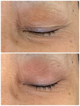 プリュネル(Prunelle)/プラズマシャワー