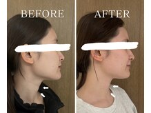 ヨサパーク アーバンヘブン 目黒(YOSA PARK Urban Heaven)/短期期間で集中ダイエット！