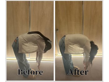 整体ラルース 中目黒(LALUZ)/20代 女性 腰痛、反り腰改善