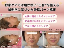 アンリエッタ(Unlieta)