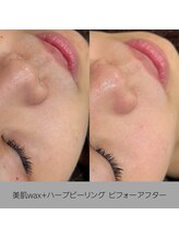 サロンベイア(salon Beia)/美肌wax+ハーブピーリング