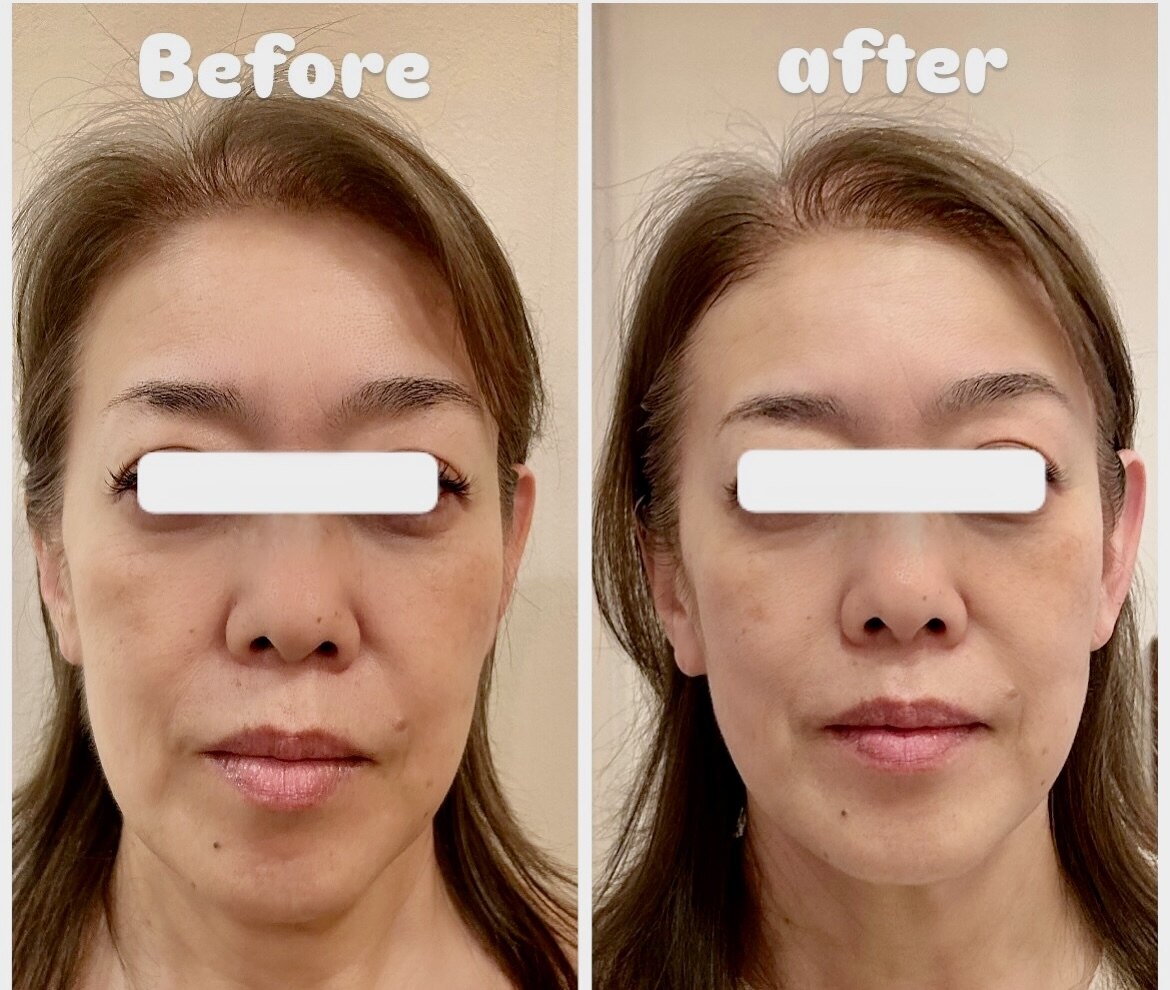 アンリール(ANRIRE)｜ホットペッパービューティー