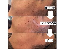 ベリール バイ ラスティ(Belile by LUSTY)の雰囲気（回数を重ねて結果が出る。諦めていたシミにもう一度向き合う）