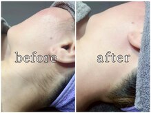 ブラン(Blanc)の雰囲気（痛みの少ない最新マシーン！完全個室でメンズ脱毛も受付中☆）