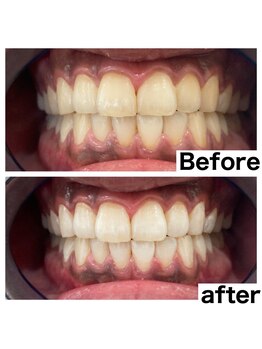 ヴィシア(VIXIA)/お客様のビフォーアフター♪