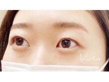 クレー(Klee)/パリジェンヌラッシュリフト