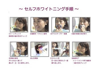 エトワール(etoile)/セルフホワイトニング施術の流れ