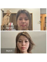 美容整体サロン プライム(Prime)/小顔矯正　ビフォーアフター