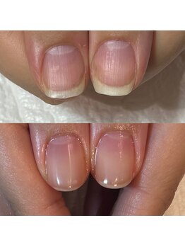 キュア(Cure.)/看護師のお客様の自爪育成