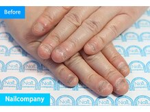 ネイルカンパニー/