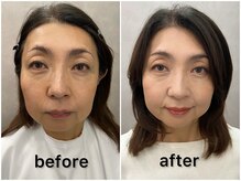 骨格リメイク バイ ムニ 恵比寿(骨格ReメイクbyMUNi)/似合うヘアメイク［恵比寿］