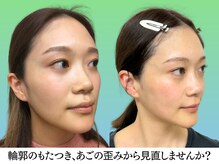 ナチュラルビューティーフェイス 横浜(NBF)