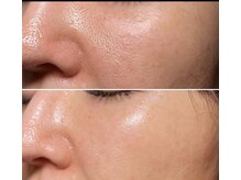 リュミエール デスポワール(Lumiere d'espoir)/白玉ピコ+プラズマ