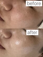 フェリノ(FERINO)/男性も美肌の時代