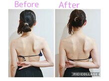 ルル(Ruru)/肩甲骨はがし/1回目