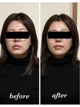 鍼灸庵利央/きれいなひとは鍼がお好き