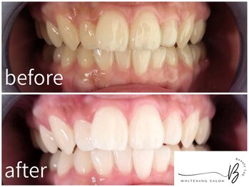 ビューティーラボ(Beauty Lab.)/before→after