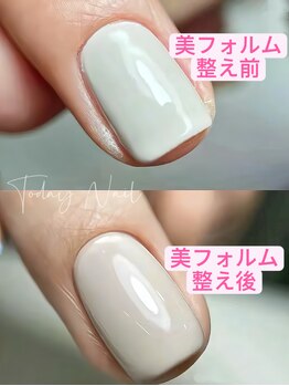 トゥデイ ネイル 新栄(Today Nail)/手がきれいに見えるネイル