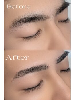 アーティス(Artis)/メンズ眉毛WAX脱毛