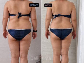 ベリッシマ 北仙台(Bellissima)の写真/体重より見た目の変化へ♪強圧オールハンドで姿勢もボディラインも美しく。お任せください！