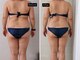 ベリッシマ 北仙台(Bellissima)の写真/体重より見た目の変化へ♪強圧オールハンドで姿勢もボディラインも美しく。お任せください！