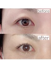 アテ アイラッシュ(Ate eyelash)/まつげパーマ