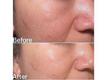 リュミエール デスポワール(Lumiere d'espoir)/白玉ピコ+プラズマ