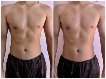 イーリバイブ/iNVYDOM MAX