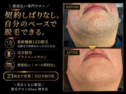 ディオン ケアナ 博多店(Dion)の写真