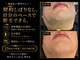 ディオン ケアナ 博多店(Dion)の写真